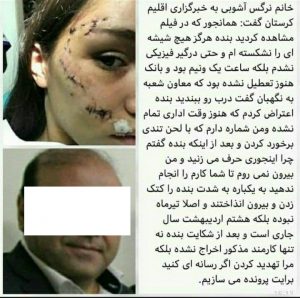 اولین تصویر از زن جوانی که توسط کارمند بانک رفاه کتک خورد